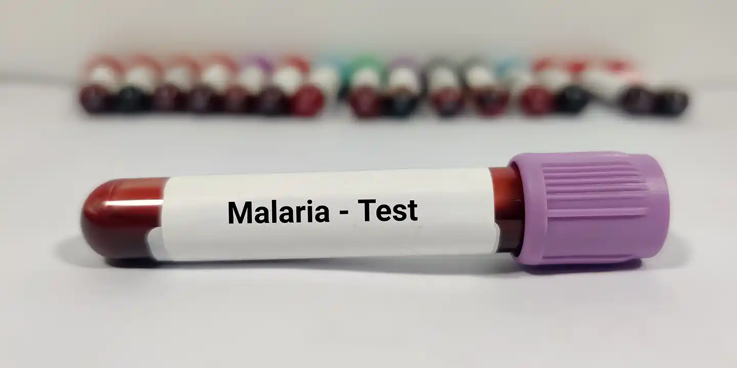 Malawi commits to taming malaria